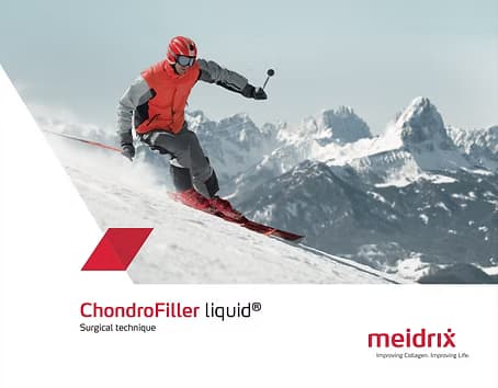 ChondroFiller Liquid technique brochure cover