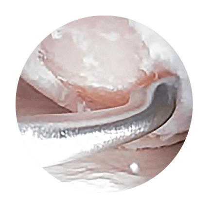 Defect preparation